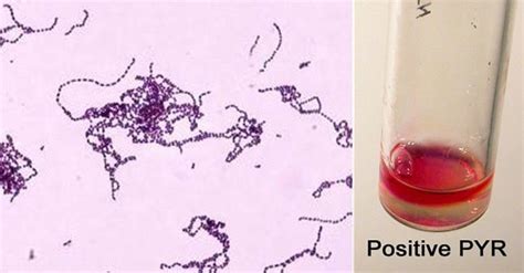 streptococcus pyogenes biochemical test|Biochemical Tests for Streptococcus pyogenes .